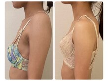 モナンジュ(ramonange)/姿勢改善