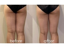 ウィール 栄 矢場町店(WE:LL)/