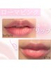 韓国最新美容ローマピンクちゅるちゅるうさぎリップモニター価格¥99,000