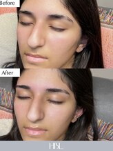 トランク(TRUNK)/新HBLお試しください♪