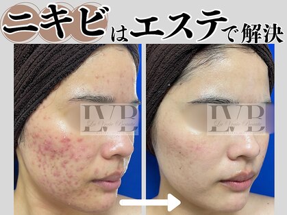 ラヴレボーテ(La Vraie Beaute)の写真