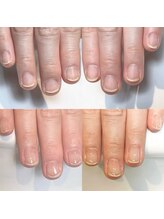 キュア(Cure.)/自爪育成ジェルネイルで爪育成