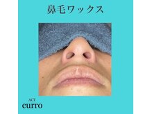 アクト クロ(ACT curro)/【鼻毛ワックス】施術例