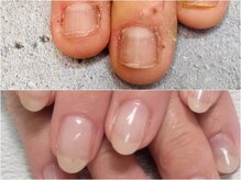 グレースレディ 神戸北店/