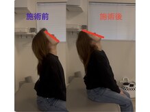 ルミエール(Rumiere)/ガチガチ首の変化