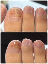 リラフ(Re:laugh)/