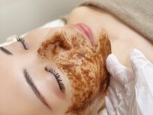 リリーベル 新宿歌舞伎町(Lily Belle)/ハーブピーリングで肌管理♪