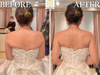 ヴェールブランシュ 町田(Vert Blanche)の写真/"丁寧&親身な専用メニュー提案"の口コミ多数!!長期でも満足度◎スゴ技STAFFが"自分史上最高"の花嫁様へ♪