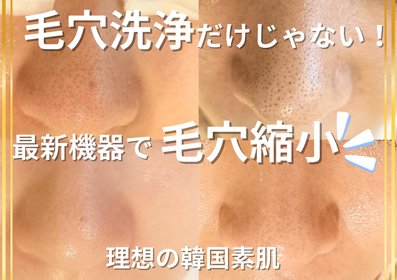 肌質改善エステサロン♡ RC8 Detox Salon元町中華街/ハーブピーリング (@rc8_motomachi