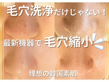 キザシ(kizashi)の写真
