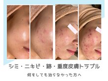 シャルナ(charna)