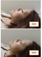 吉川美南ライフ整骨院/30代女性