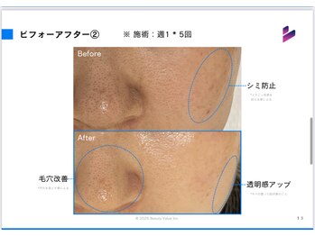サロン チコルル(salon chikolulu)/