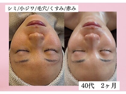 シェリー トウキョウ 西葛西店(Cherie Tokyo)の写真