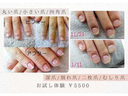 スノー(SNOW)の写真