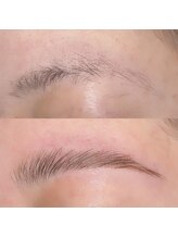 エール(AILE)/ハリウッドブロウリフト