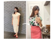 エピファニー 東京 銀座/ビフォーアフター（A.Y様）