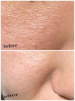 すっぴん美肌革命/角質オフで、つるん肌に変身