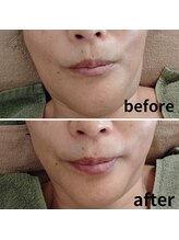 心音/シャープなフェイスラインへ。