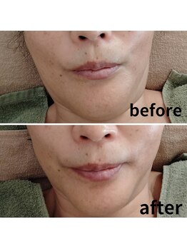 心音/シャープなフェイスラインへ。