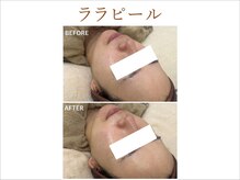 ティアム バイ テトテ 神戸三宮(TIAM by tetote)/ララピール