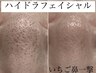 【毛穴レス肌】ハイドラ洗浄&ヒト幹細胞(歯髄)導入