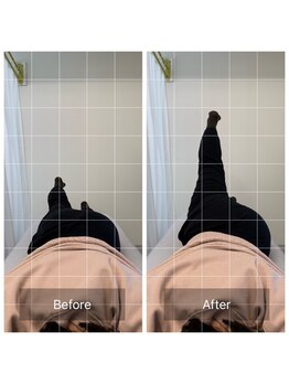 ナオル整体 恵比寿院(NAORU整体)/恵比寿/整体事例【骨盤矯正】