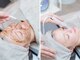 リファラ 光の森店(REFALA)の写真/憧れの韓国女優肌へ♪【ハーブピーリング＋ハイドロ毛穴洗浄★¥8800】ニキビケア＆毛穴の黒ずみも撃退！