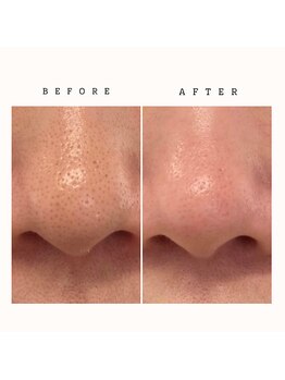 ディオ(Dio)/小顔+毛穴ケアが同時に叶う！