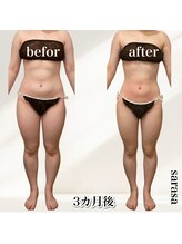 ナチュラル ビューティー スタイル さらさ(Natural Beauty Style)/さらさ痩身プログラム3カ月後