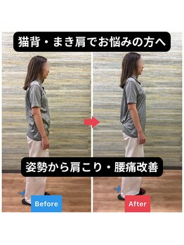 五反田K&M整体院の写真/猫背・まき肩、デスクワークによる辛い肩こり・腰痛に！体の歪みケアで軽やかな毎日を◎