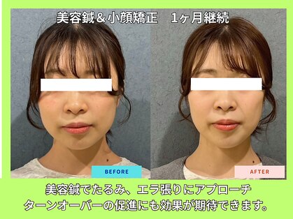 晴々の写真