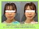 晴々の写真