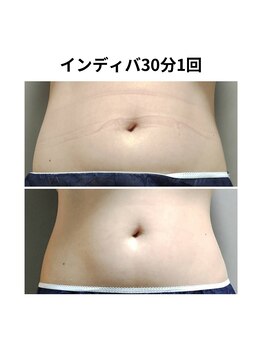 オンケイ(Onkei)/一回でもスッキリがわかる!