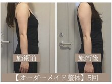 ドクターボディ 恵比寿店(Dr.Body)/【猫背/巻き肩の改善施術】