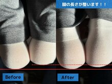 鈴家/脚長差にも変化が出ます！