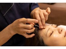 あかり鍼灸接骨院の雰囲気（お悩みに合わせたオーダーメイド美鍼もおすすめ）