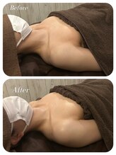 ワンバイゼロ(One by zero)/ボンボンバストBefore→After