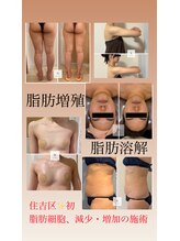 パピヨン(Papillon)/脂肪増殖・減少