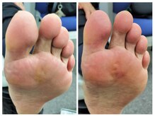 フレッシュフット(FreshFoot)/足のトラブルお任せください