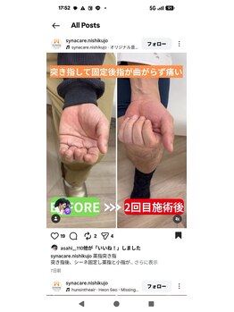 シナプス整体院 北さん/指などの不調にも！！