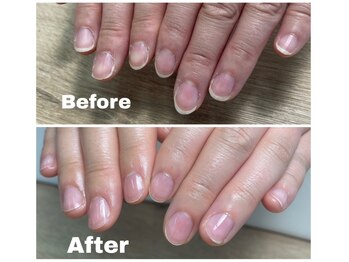 マニネイルケア 府中店(maninail CARE)/ビフォーアフター