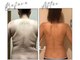 ヨサパーク ヒロイン 府中(YOSA PARK heroine)の写真/痩せたい方は痩身専門店で本気のダイエット!!ハーブ蒸しLULUONNで「痩せる汗」を流して脂肪燃焼!