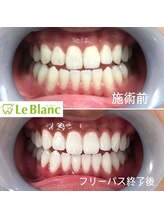 ルブラン 奈良店(Le Blanc)/いつでも歯は大切に！