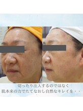 マリー エクラン/