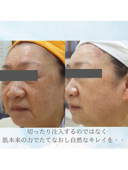 マリー エクラン/