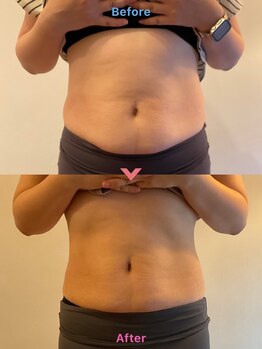 ドゥードル(doodle)/