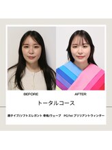 シュアリー(Surely)/トータルコースお客様事例