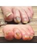 【フット爪カットのみ】☆ご自分でカットできない方大歓迎！