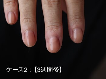 イズ(...is)/自爪育成　